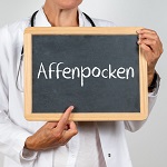 Affenpocken Froreich